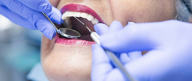 Best Emergency Denture Repair in East Cleveland, OH